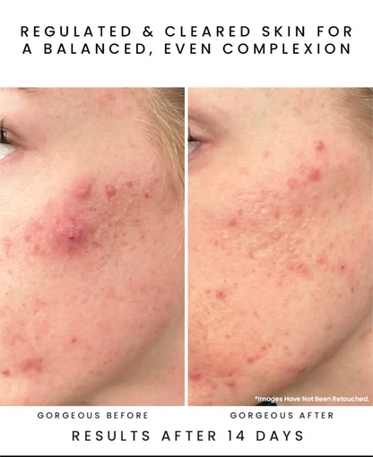 Glow Juice 10-Acid Refining Peel (1oz)