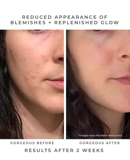 Oasis Deep Pore Gel Cleanser